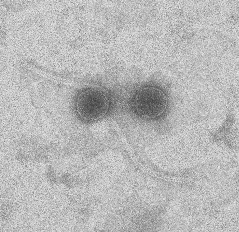 A sample view under a microscope