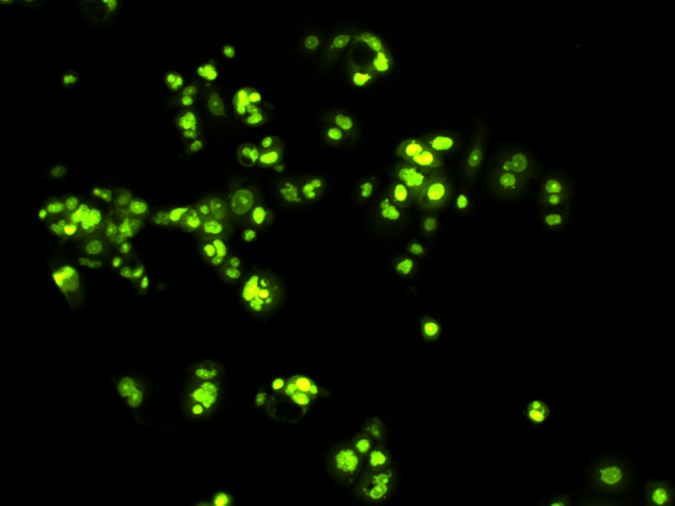 Human breast cancer cells (MCF-7): control (untreated)