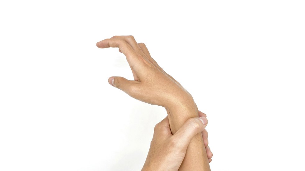 [Translate to English:] Widok dłoni chorego na MPD w nienaturalnym wygięciu