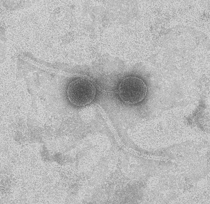 A sample view under a microscope