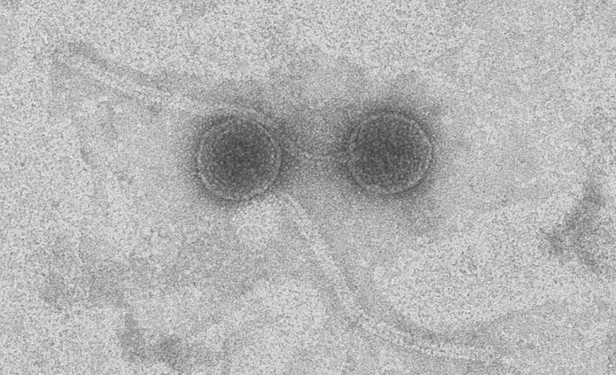 A sample view under a microscope