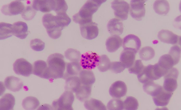 próbka pod mikroskopem