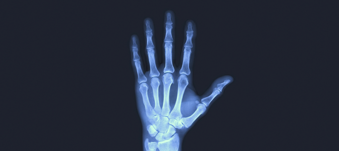 hand x-ray