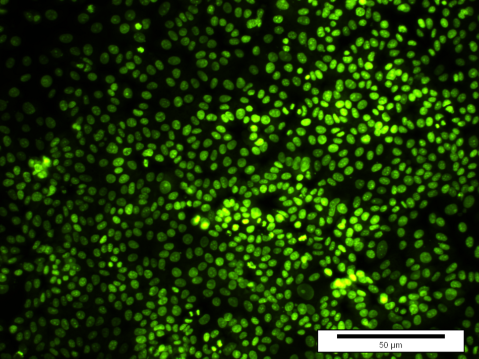 Human breast cancer cells (MCF-7) 48 hours after adding the tested capsules (synthesised on the basis of SDS and filled with the anticancer drug – paclitaxel at a concentration of 10 nM) to the in vitro culture. After administration of the capsules, a clear decrease in the number of cells and a reduction in the rate of their division were noted. The cells were stained with the fluorescent marker CyQuant